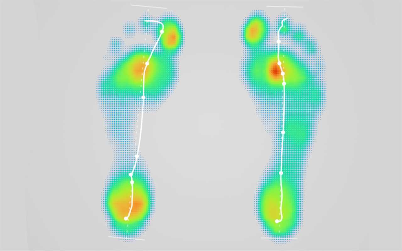 The pressure I place on my feet while walking is indicated here (red being the most pressure and blue being the least). The lines show my foot angle and direction while walking.